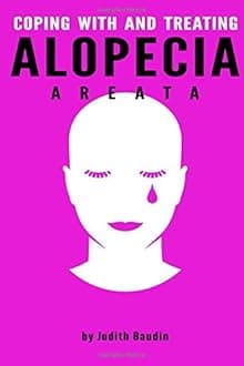 Alopecia Areata: Coping With and Treating Alopecia Areata