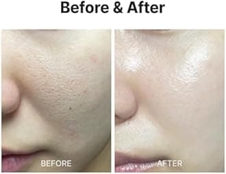 MEDITHERAPY Wrinklt-fit Mask(7EA), Collagen Mask, Lifting Sagging Skin, Hydrating & Firming, Smoothing Fine Lines, Improving Elasticity, Glass Skin, Korean Skincare