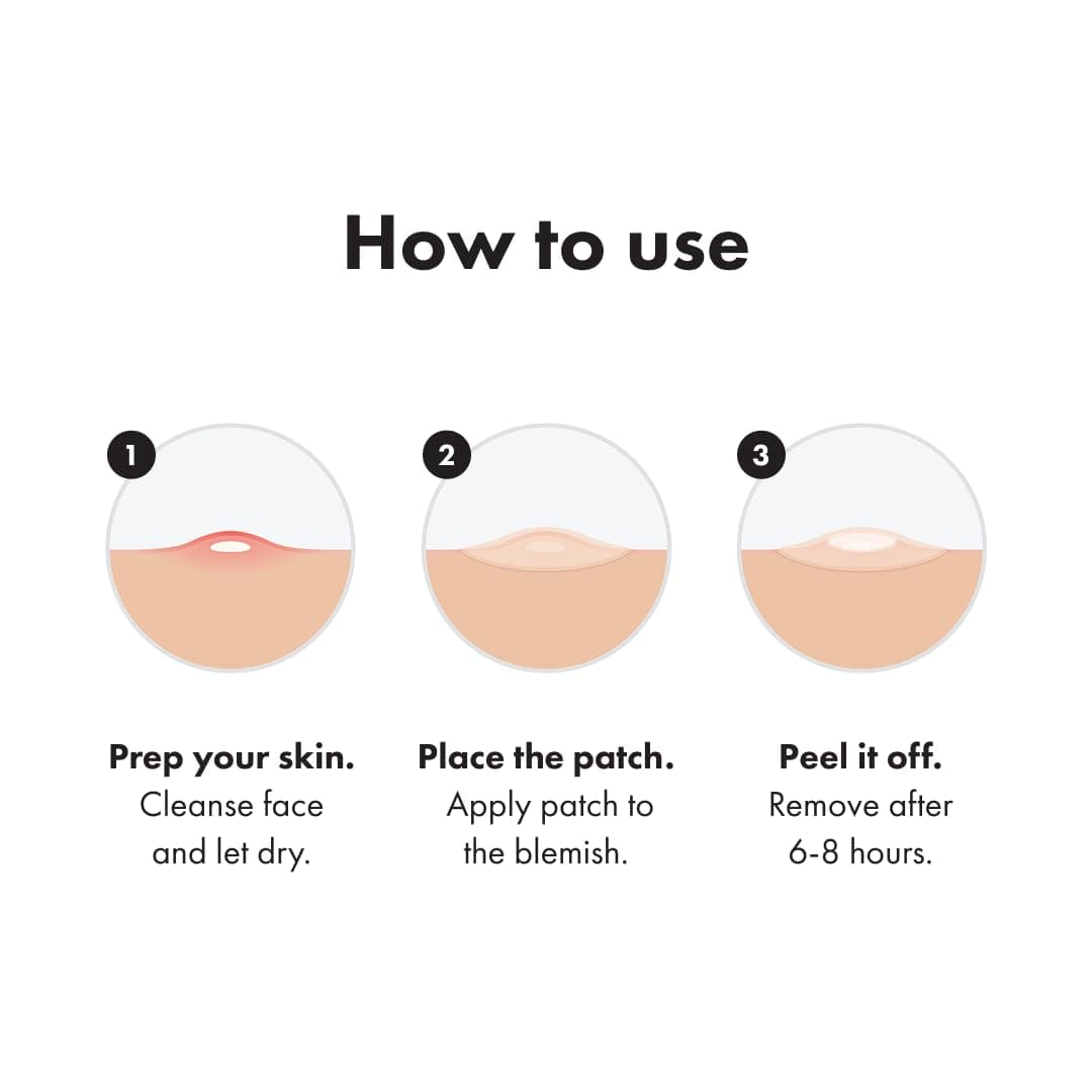 Mighty Patch Hero Cosmetics Invisible+ Patch – The Barely-There Daytime Hydrocolloid Acne Pimple Patch for Covering Zits and Blemishes, Tapered Edges Designed to Blend Into Skin (72ct)