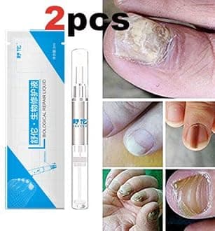 Euconychia Herbal Nail Treatment Pen Nail Repair Fingernails Toenails Rich Nutrition