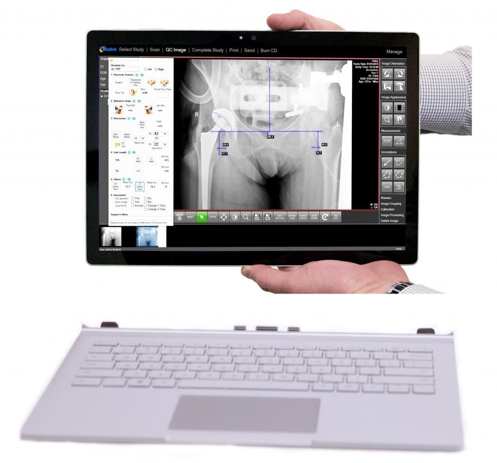 Radlink DR PRO TABLET Direct Radiography System with Flat Panel Detector