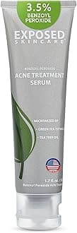 Exposed Skin Care Acne Treatment Serum - 24 Hour Spot Treatment, Reduces Pimples and Blemishes Gently and Effectively with 3.5% Benzoyl Peroxide, Natural Green Tea & Tea Tree Oil