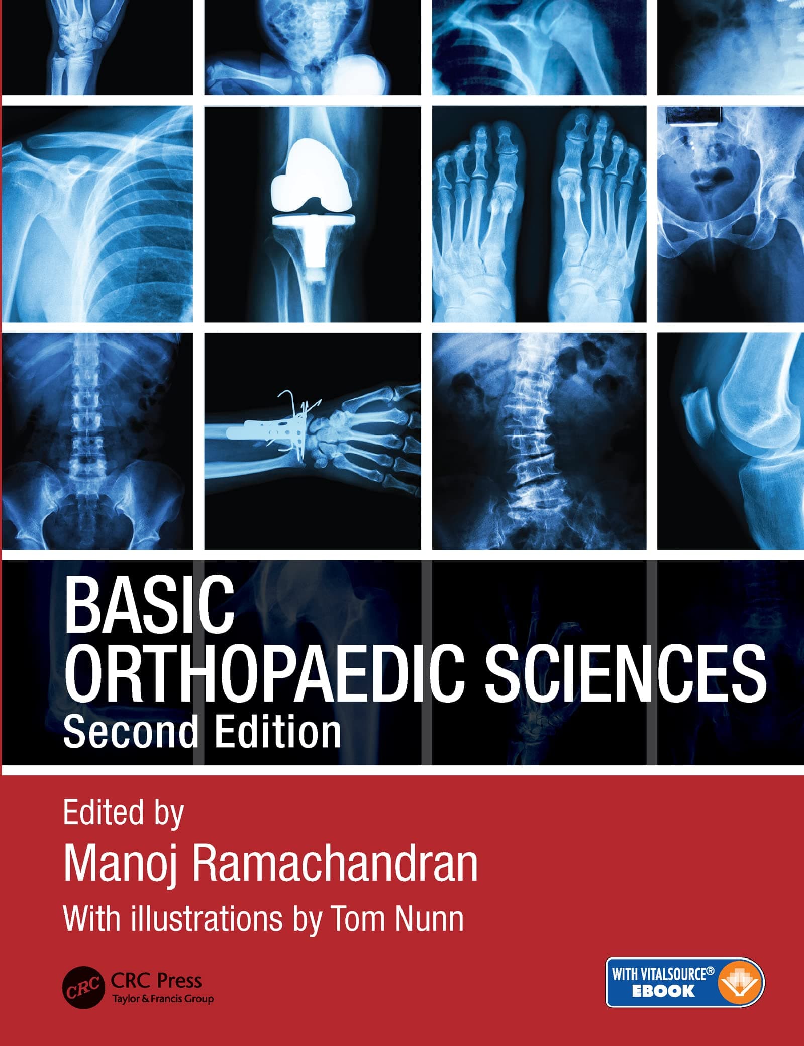 Basic Orthopaedic Sciences